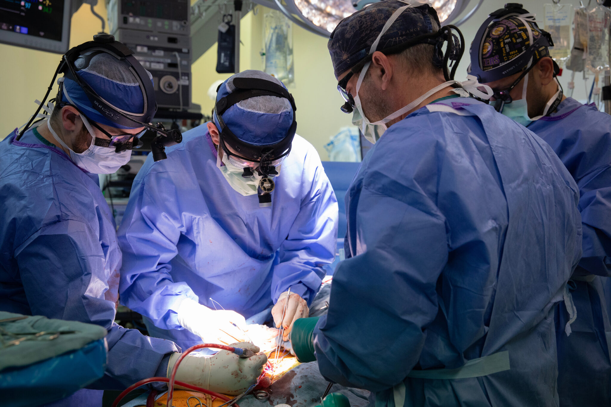 Vanderbilt Health performed a record number of solid organ transplants in fiscal year 2026 — 981 lifesaving procedures among its adult and pediatric programs. (photo by Erin O. Smith)