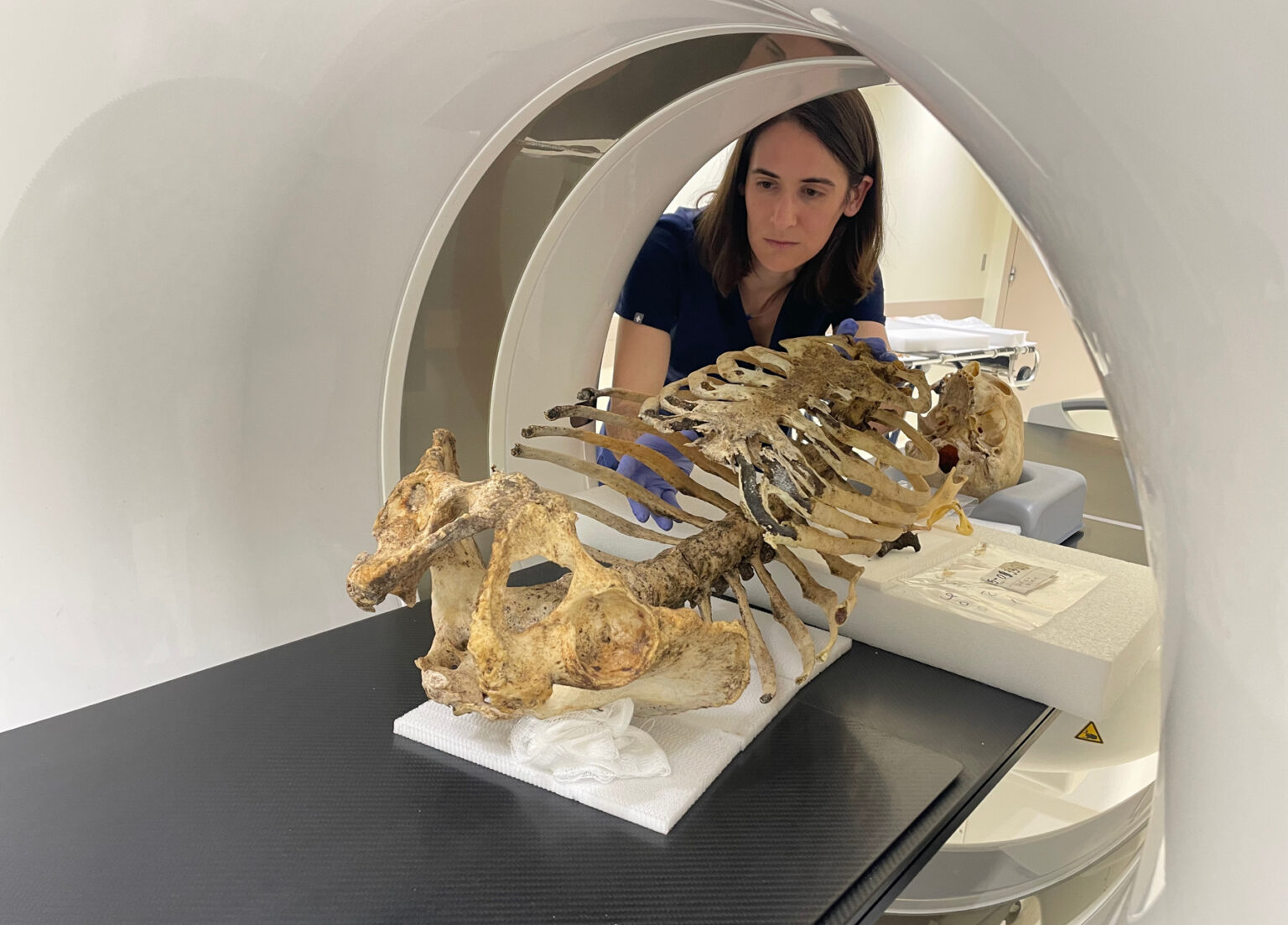 Katherine Van Schaik, MD, PhD, MA, positions skeletal remains in a CT scanner.