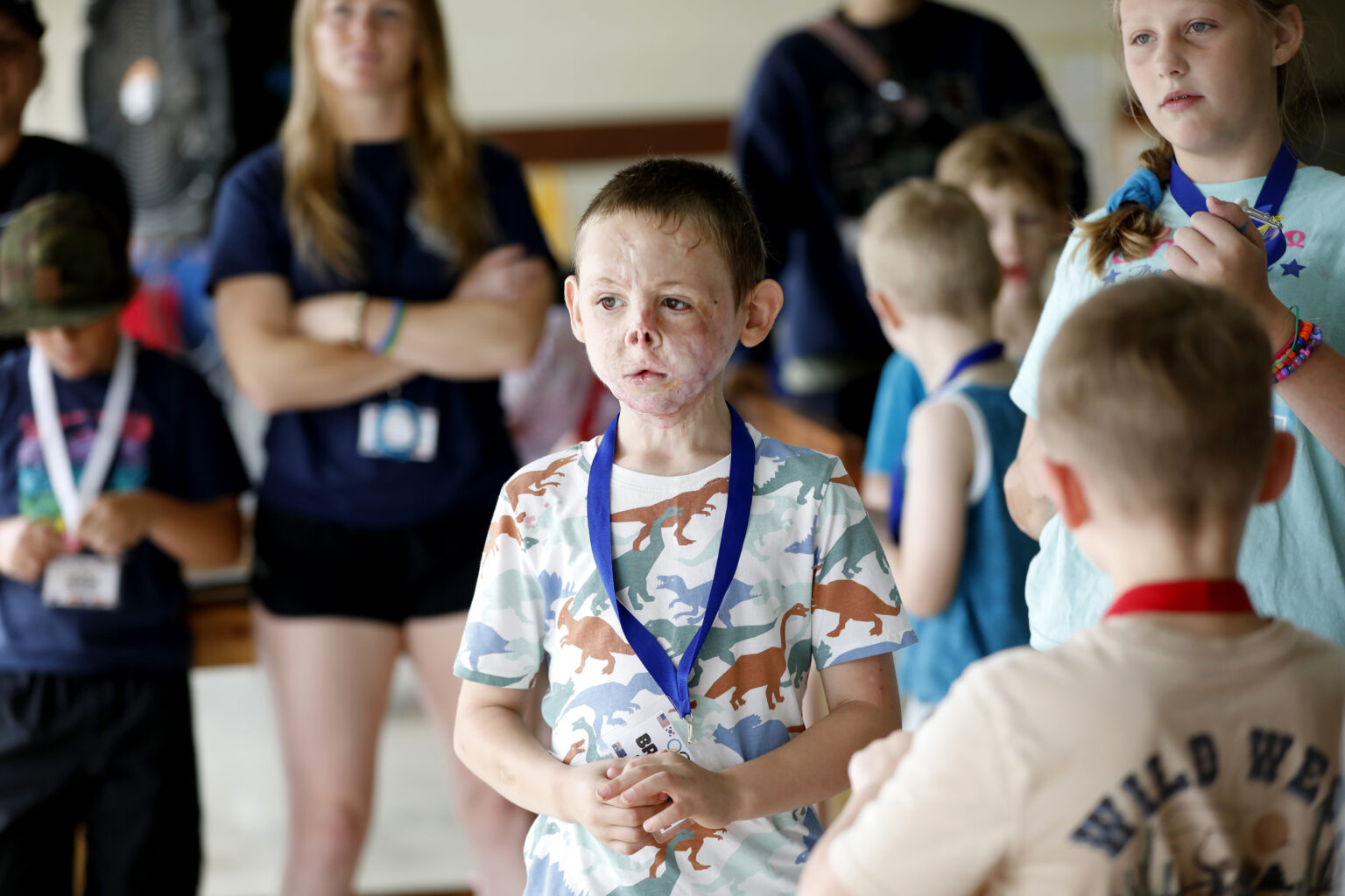 Brayden Thrasher, 7, attends Camp Hope, a three-day experience for burn survivors. (photo by Donn Jones)