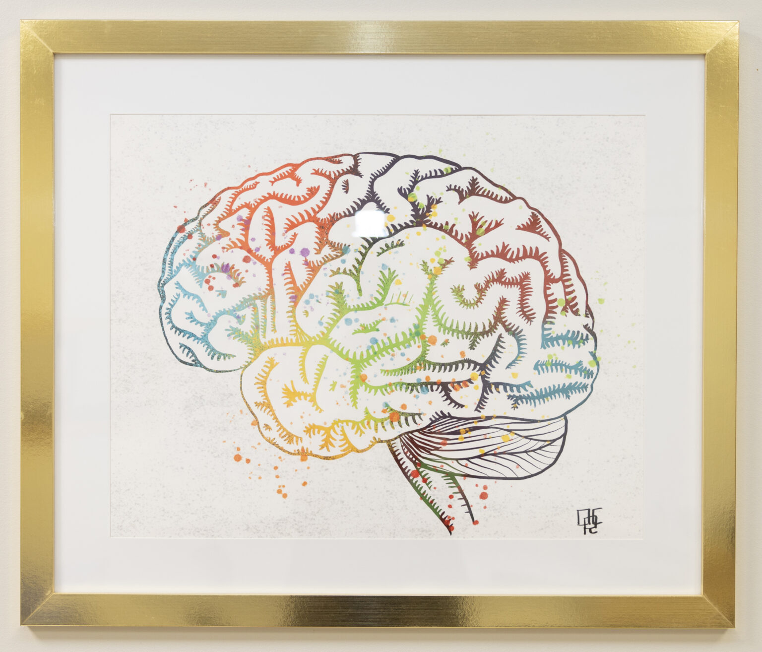 Artwork by Curfman decorates the walls of The Vanderbilt Neurology Clinic. (photo by Erin O. Smith)