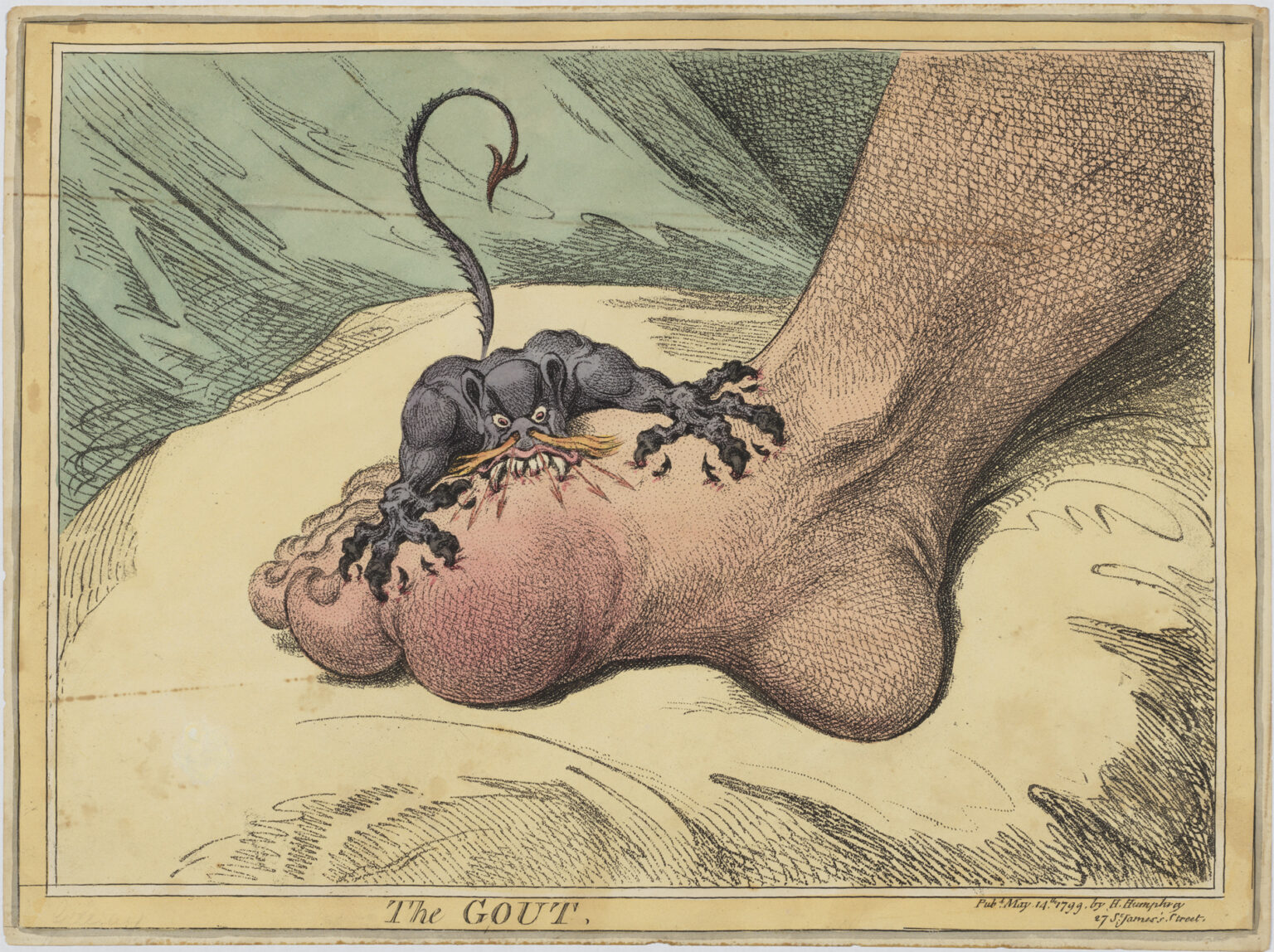 “The Gout” by British artist James Gillray is a hand-colored soft-ground etching from 1799 and is in the collection of the Metropolitan Museum of Art. (public domain)