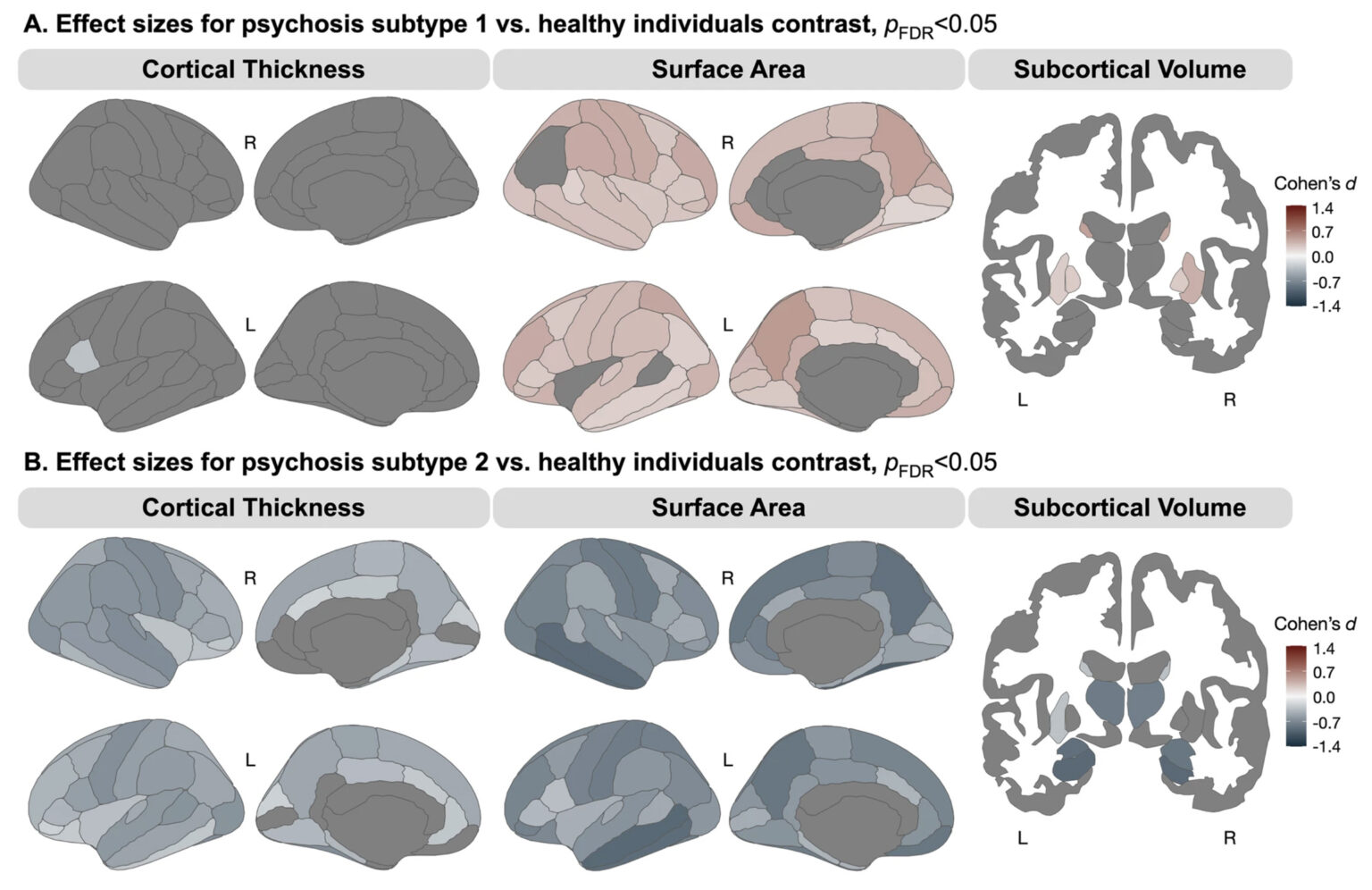 A. Compared to healthy individuals, psychosis subtype 1 demonstrated significantly larger surface area across the cortex and larger basal ganglia volumes. B. Compared to healthy individuals, psychosis subtype 2 demonstrated widespread lower surface area and cortical thickness, and smaller subcortical volumes. (Hill, L.D., et al. Subtyping psychotic disorders using a data-driven approach reveals divergent cortical and cellular signatures. Mol Psychiatry (2026). https://doi.org/10.1038/s41380-026-03774-2. Creative Commons Attribution 4.0 International License: http://creativecommons.org/licenses/by/4.0/. Rights and Permissions: https://tinyurl.com/2e9nxeah.)