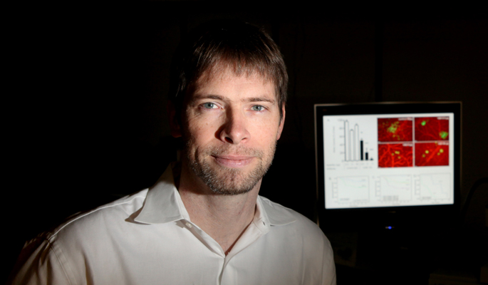 Andries Zijlstra, Ph.D., and colleagues are studying a biomarker that can help predict prostate cancer recurrance. (photo by Susan Urmy)