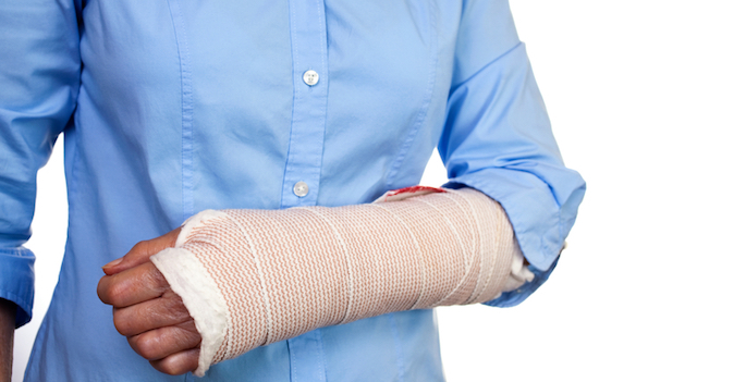 older woman with arm in cast