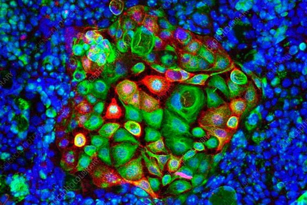 Photograph by Microscopy Australia, University of Sydney/Science Photo Library