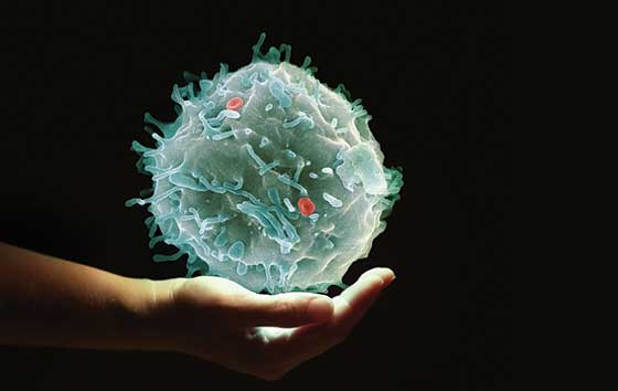 Stem cell transplant Stem cell transplant