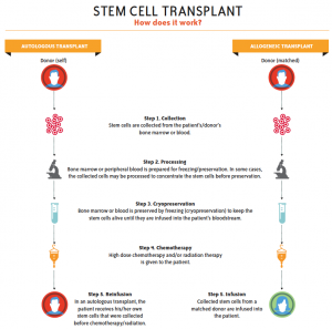SCT illustration Stem cell transplant illustration