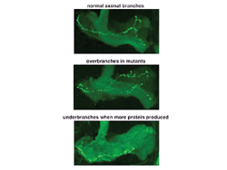 Nerve cell axonal projections from the brain of a normal fly (left), a fly with a mutant Fragile X protein (center), and a fly with overexpression of the Fragile X protein. Mutants show increased branching and excessive growth, whereas over-expression of the protein causes loss of branching and reduced growth. Courtesy Kendal Broadie, Ph.D.