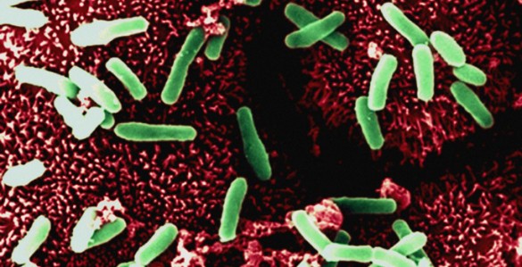 B0003412 Clostridium on gut lining - coloured