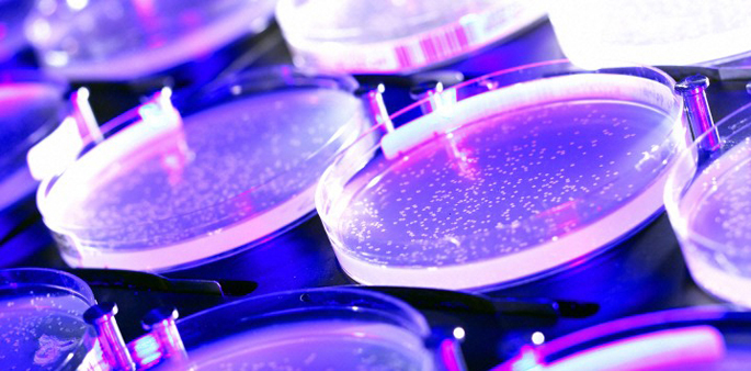 B0004299 Petri dishes with colonies of E. coli